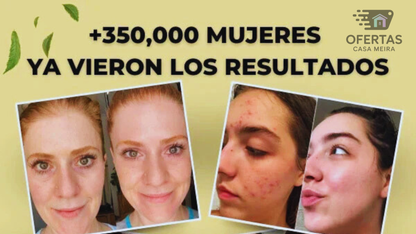 Crema de miel y sebo de res Anti-Envejecimiento